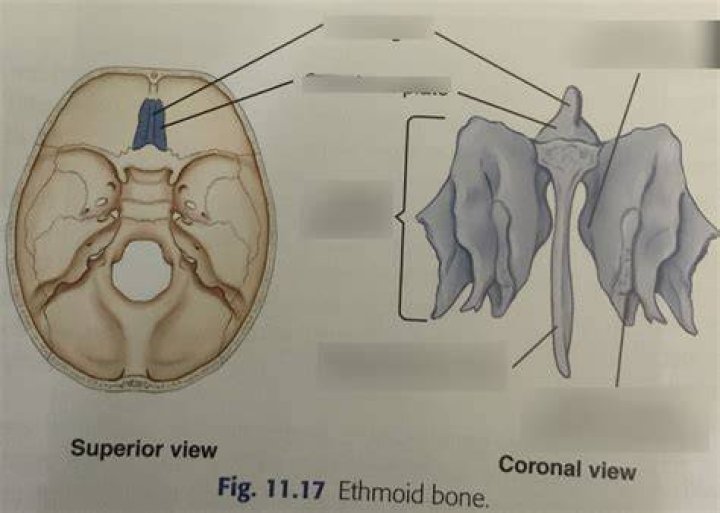 Ethmoid Bone Quiz