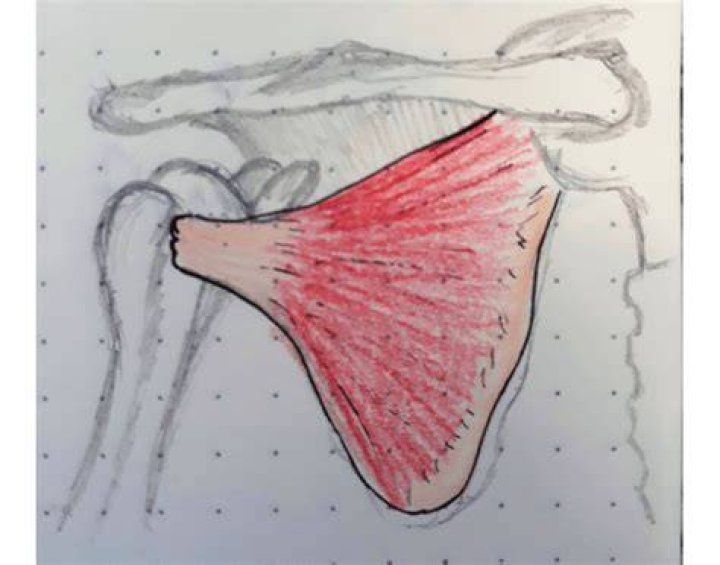 Músculo Subescapular Quiz