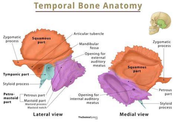 temporal bone (internal)